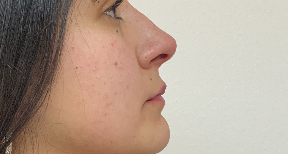 despues-rino-01-01-01-01